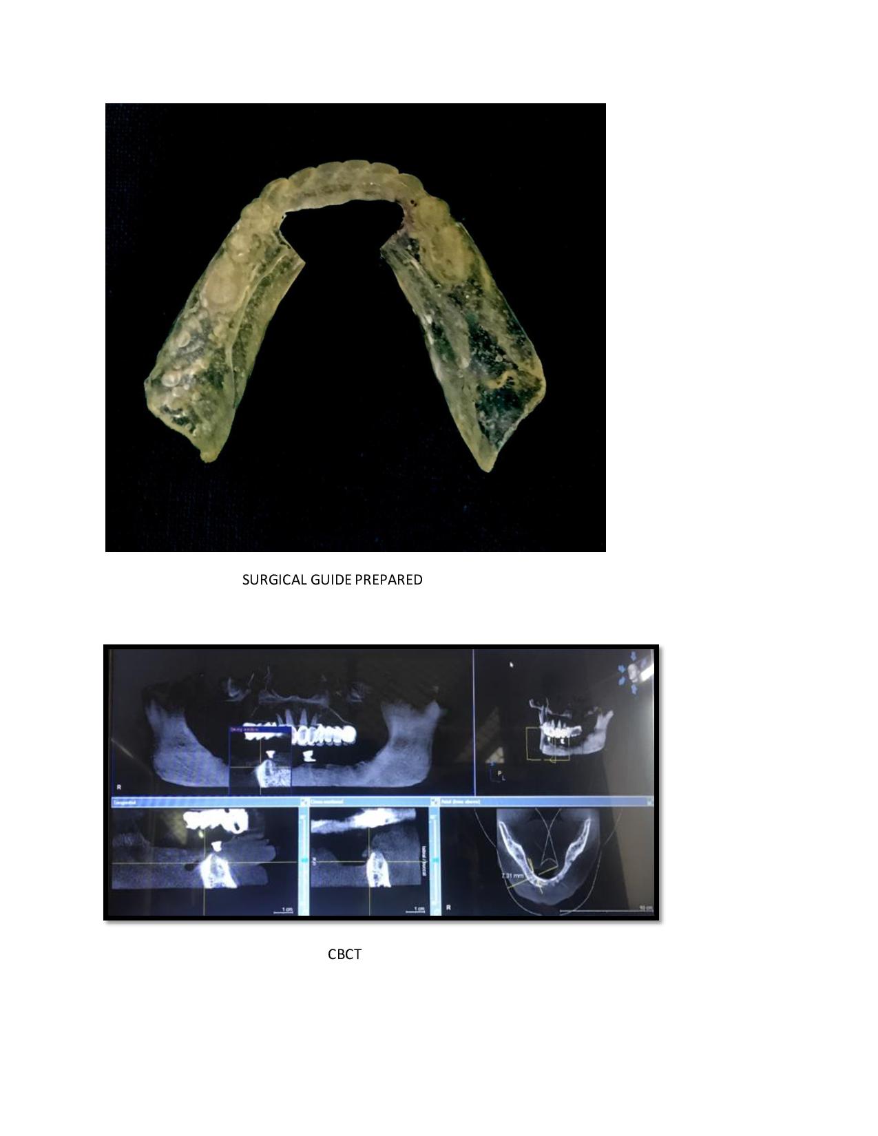 case report for the department of prosthodontics in the section of health informatics
